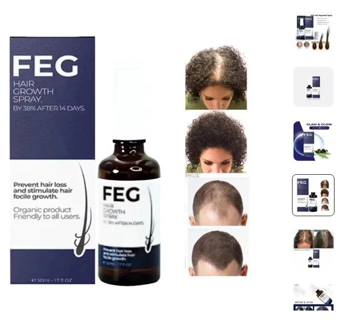 FEG hair growth spray with derma roller showing product bottle and before and after hair growth results