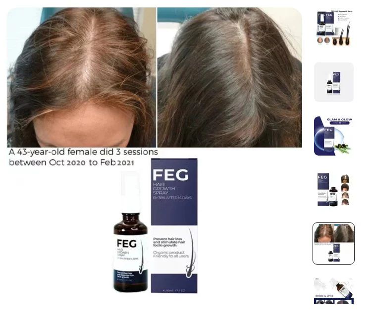 Before and after hair growth results using FEG hair growth spray with derma roller on thinning scalp