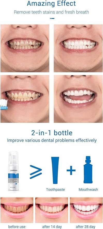 Trending Height teeth whitening mousse showing before and after results with improved teeth whiteness and fresh breath in 28 days