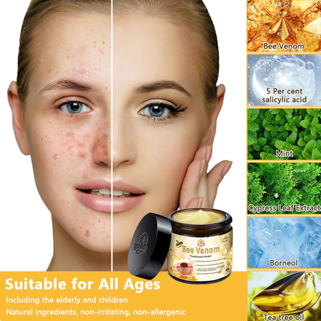 Before and after comparison of woman’s face showing clear skin using bee venom face cream by Trending Height